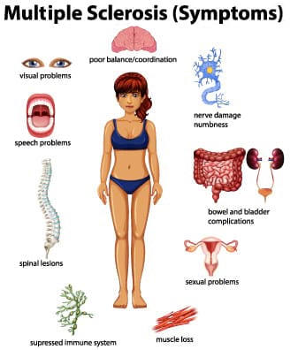 Multiple Sclerosis Symptoms - Hohman Rehab and Sports Therapy