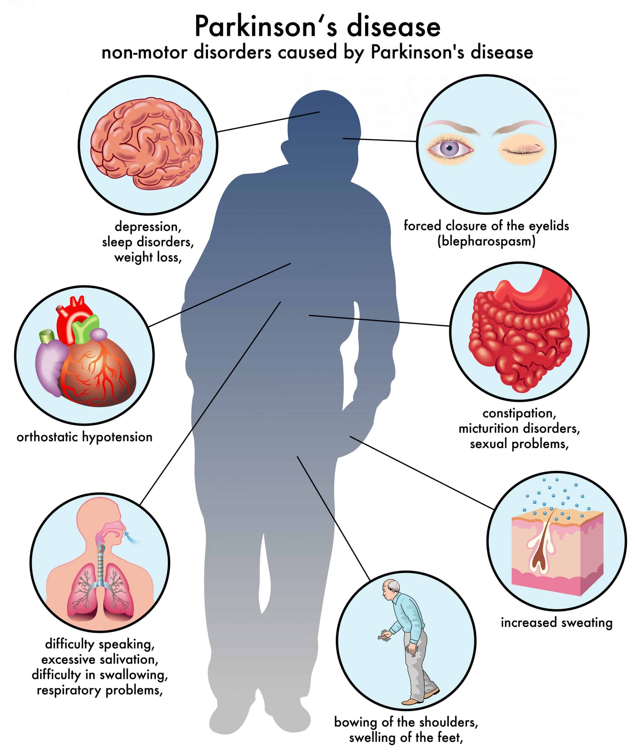 parkinsons disease nursing diagnosis impaired physical mobility